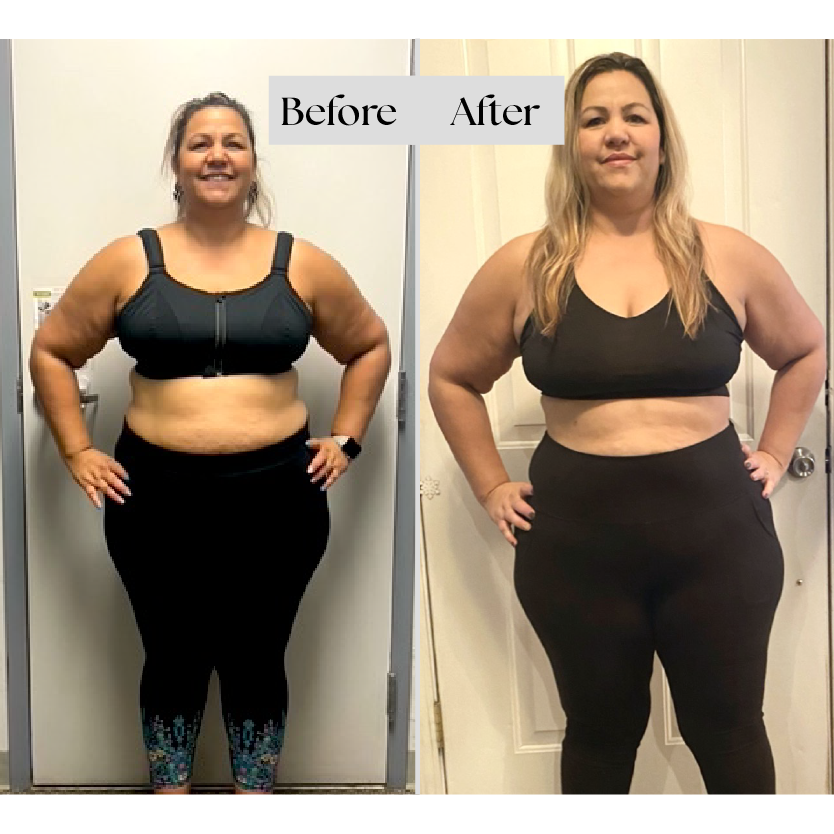before and after front