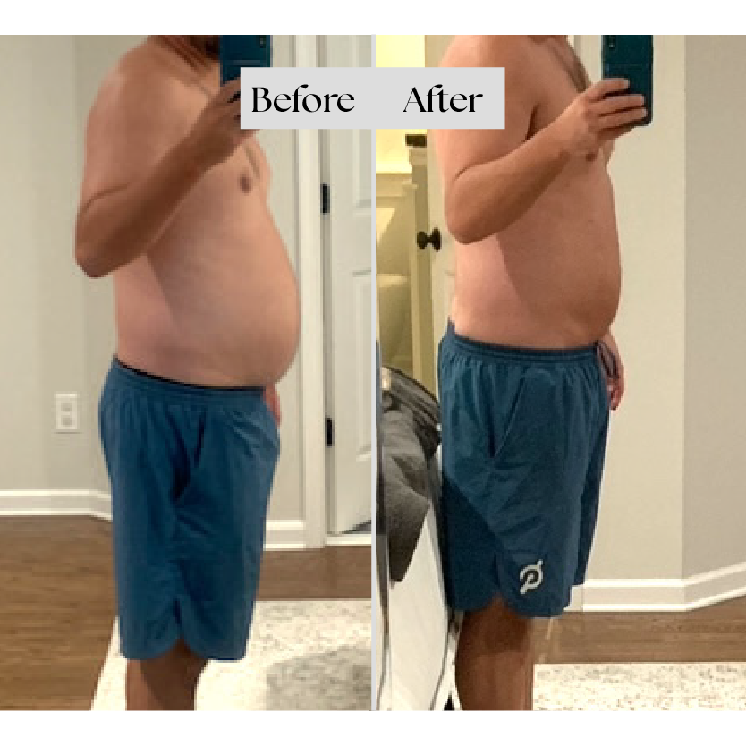 side before and after